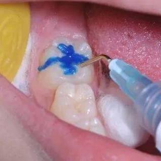 深圳考拉口腔诊所是正规医院吗？