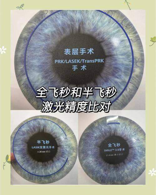 中山大学附属第七医院眼科怎么样