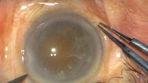 福建南平建瓯亮睛眼科医院特色项目及技术优势