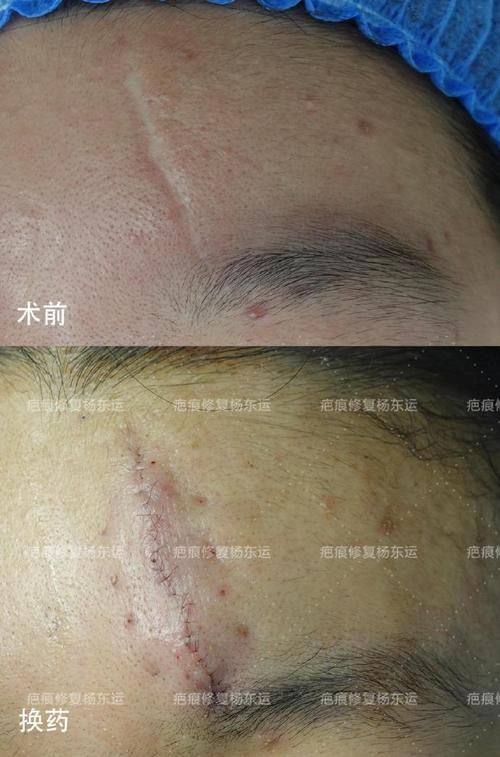 汕头肤康皮肤科门诊部收费价格表/收费标准