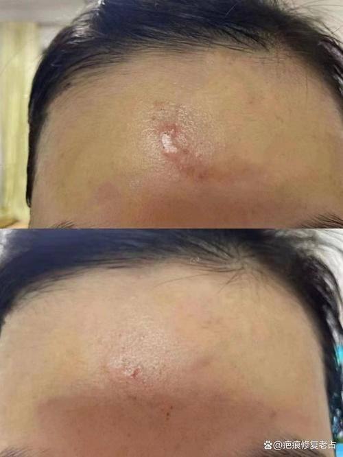 汕头肤康皮肤科门诊部详细的预约挂号方式及流程