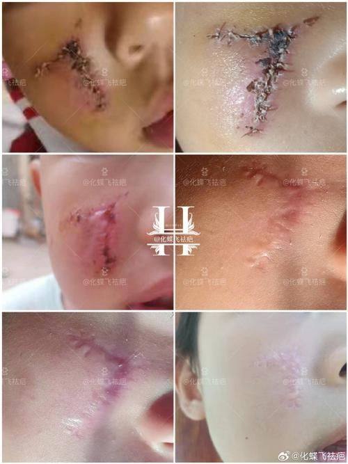 汕头肤康皮肤科门诊部真人口碑评价怎么样？