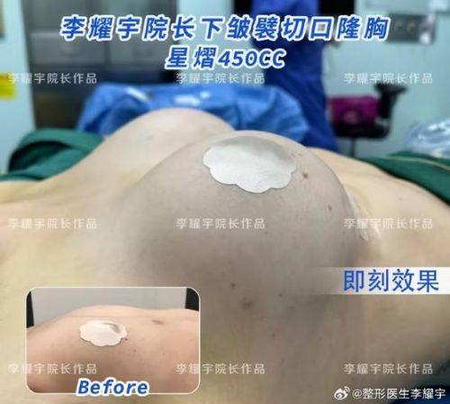 郴州市第三人民医院医疗美容科是正规医院吗？