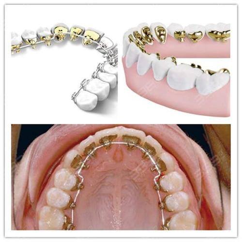 鞍山沐新口腔门诊部真人口碑评价怎么样？