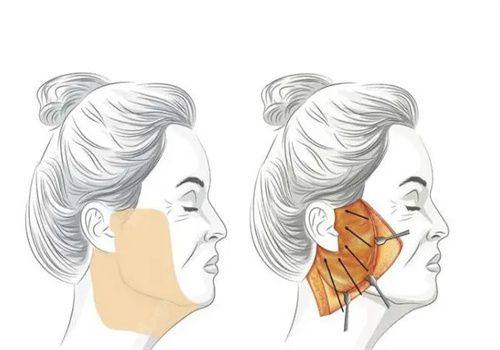 宁波星范医疗整形美容是正规医院吗?