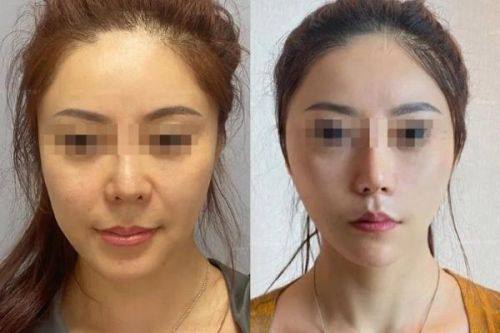 湖南常德美莱整形详细的预约挂号方式及流程