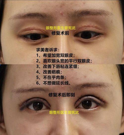 宁波星范医疗整形美容详细的预约挂号方式及流程