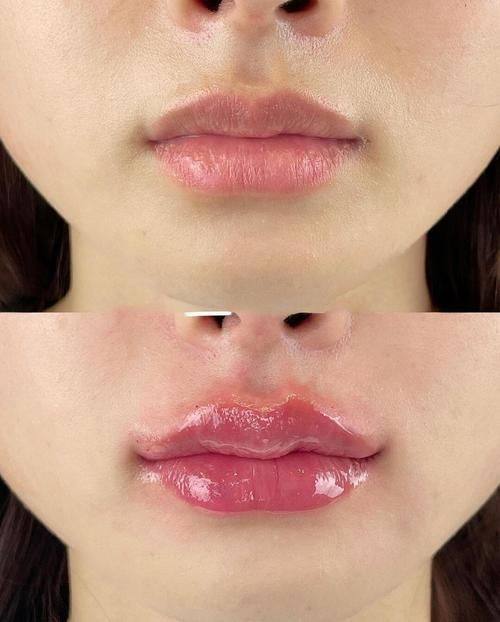 哈尔滨唐雪菲医疗整形美容诊所收费价格表/收费标准