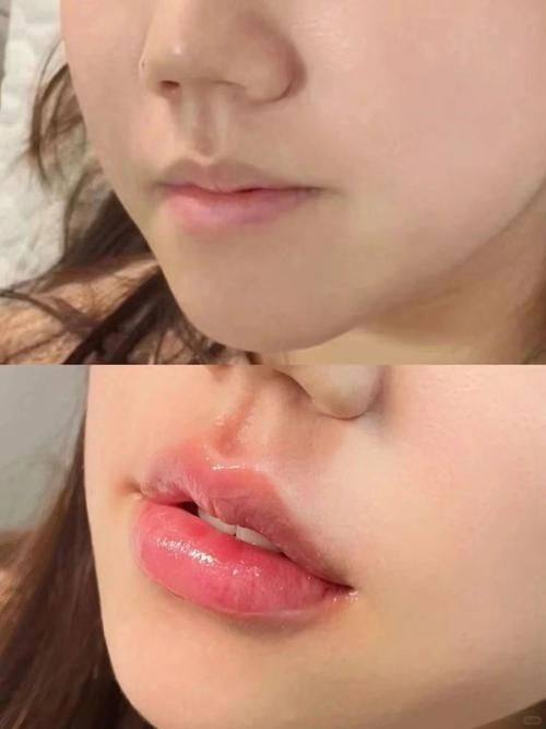 哈尔滨唐雪菲医疗整形美容诊所真人口碑评价怎么样?