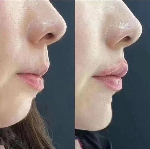 温州乐清顾得美整形医院真人口碑评价怎么样？