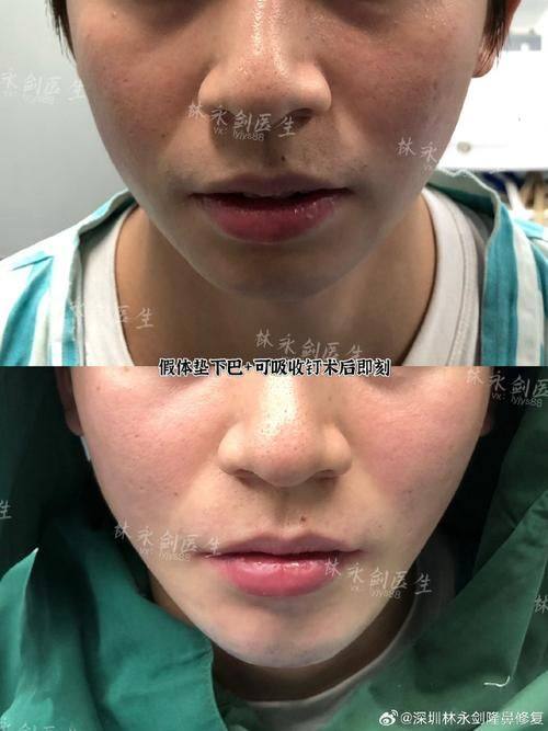 温州乐清顾得美整形医院详细的预约挂号方式及流程