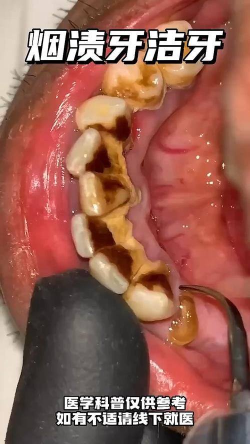 沈阳市第五人民医院口腔科地址电话营业时间