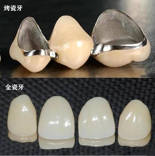 安徽蜀山区泰康拜博口腔收费价格表/收费标准