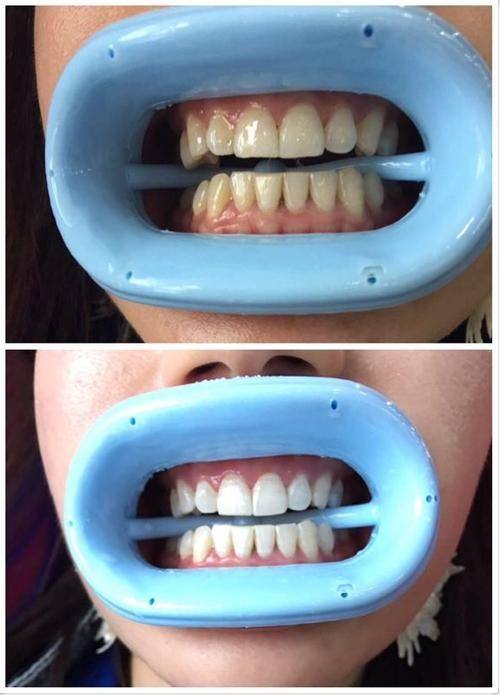 安徽蜀山区泰康拜博口腔真人口碑评价怎么样?