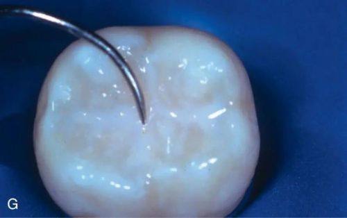 沈阳市第五人民医院口腔科医生团队实力强大及骨干医生简介