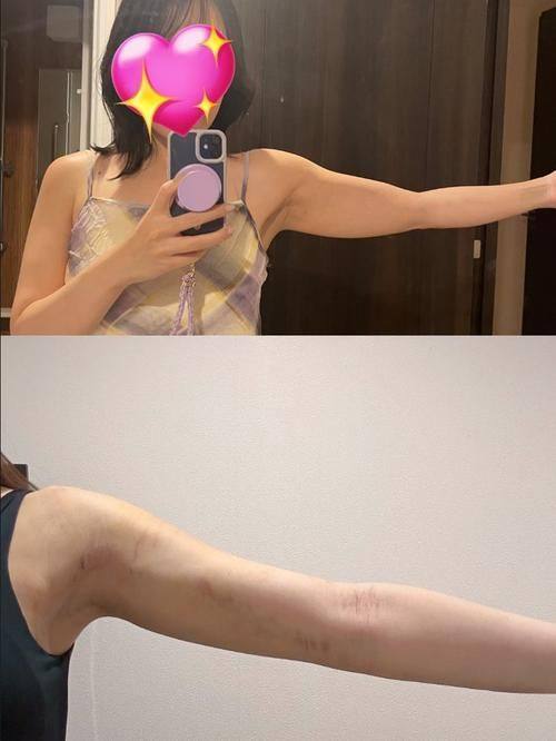 日本有乐町高野美容整形医院详细的预约挂号方式及流程