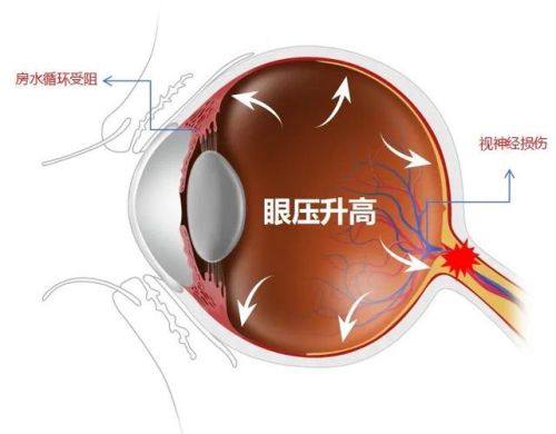 云南玉溪艾维眼科医院收费价格表/收费标准