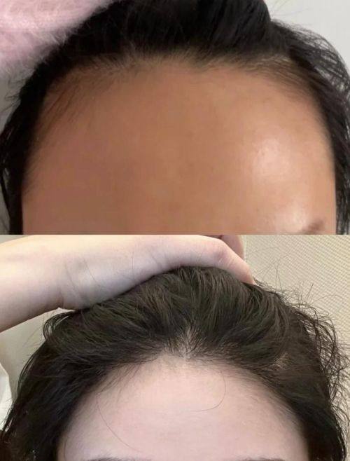 西安科美妍植发中 心地址电话营业时间