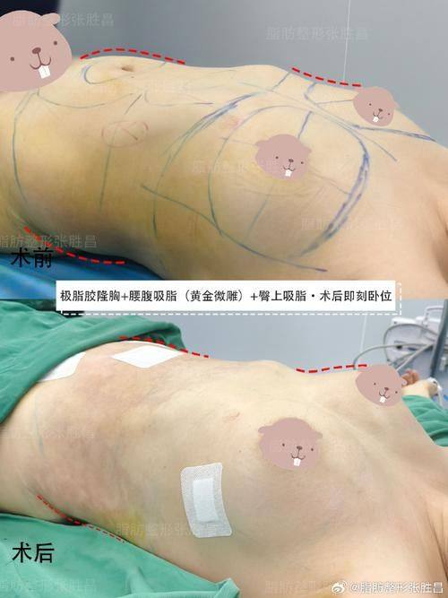 温州乐清顾得美整形医院是正规医院吗？