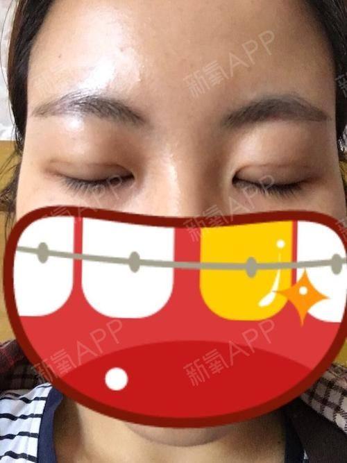 日本有乐町高野美容整形医院真人口碑评价怎么样?