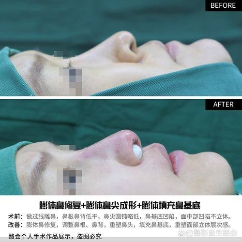 日本有乐町高野美容整形医院特色项目及技术优势