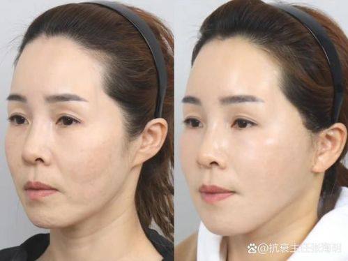 湖南常德美莱整形真人口碑评价怎么样？