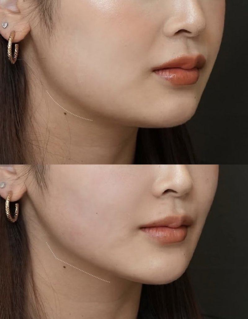 湖南常德美莱整形是正规医院吗？