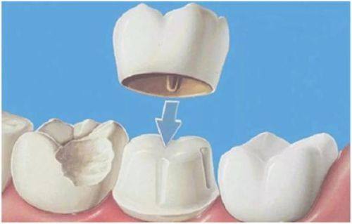 内蒙古包头佳洁一口腔门诊部真人口碑评价怎么样？