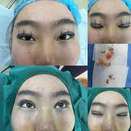 海南曙光梦妮幻整形专科门诊部详细的预约挂号方式及流程