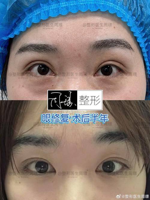 东莞西妃整形美容医院真人口碑评价怎么样？