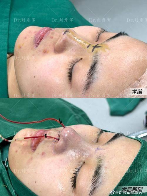 东莞西妃整形美容医院特色项目及技术优势