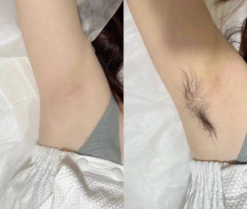 邵阳幻都荣恩整形医院是正规医院吗?