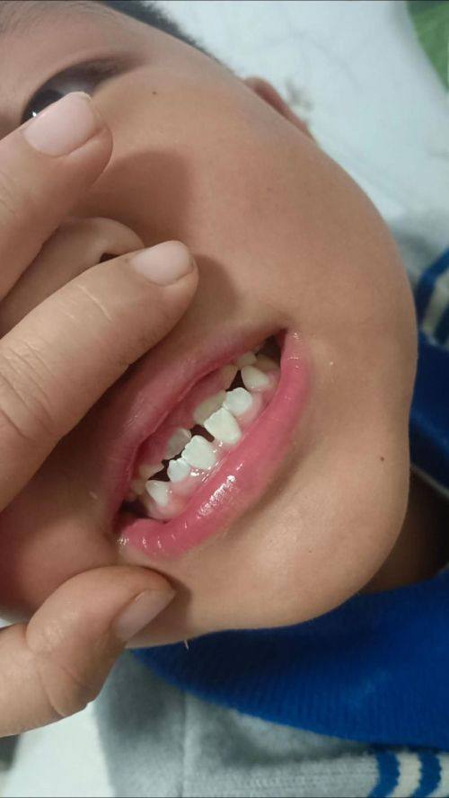 湖南益阳高新博悦口腔特色项目及技术优势