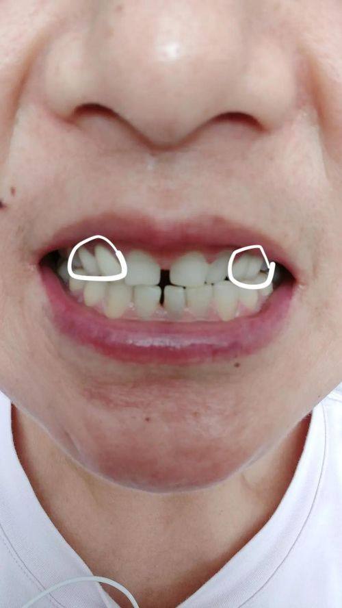 江苏常州今日口腔详细的预约挂号方式及流程