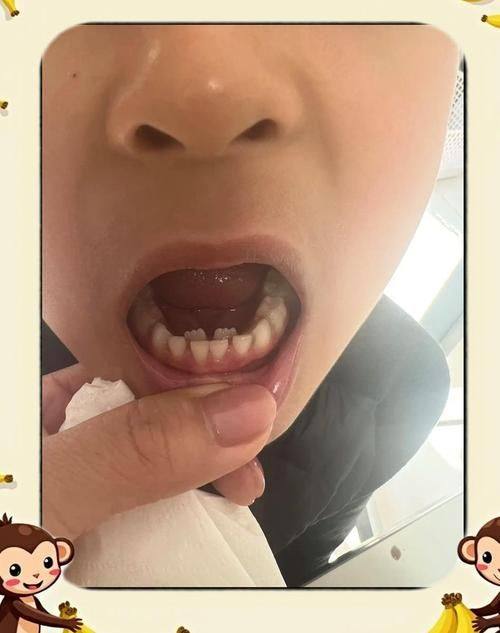 衢州蓝芽口腔地址电话营业时间