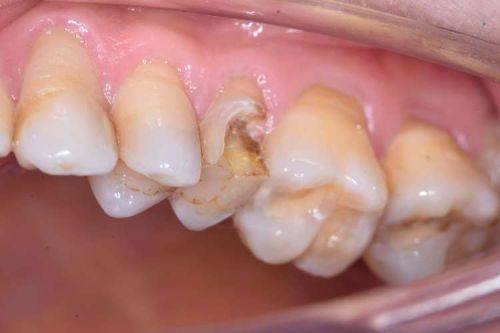 内蒙古包头佳洁一口腔门诊部收费价格表/收费标准