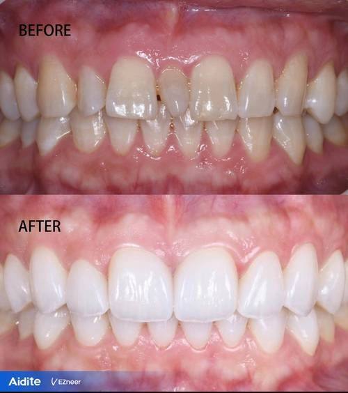 福州仓山薇雅口腔门诊部详细的预约挂号方式及流程