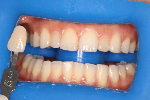 江苏常州今日口腔收费价格表/收费标准