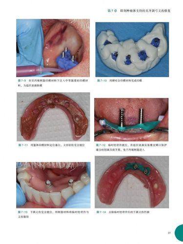 内蒙古包头佳洁一口腔门诊部地址电话营业时间