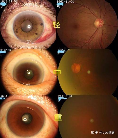 华中科技大学同济医学校附属同济医院眼科收费价格表/收费标准
