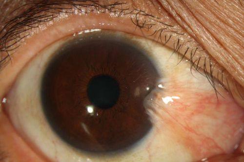 青岛中青大眼科是正规医院吗？