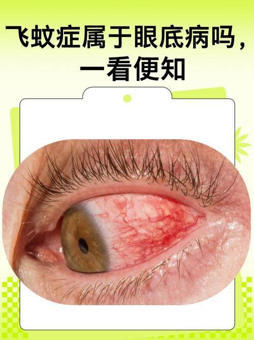 茂名电白爱尔眼科视光医院有限公司真人口碑评价怎么样?