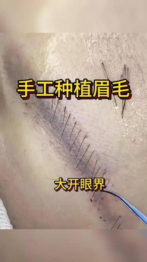 襄阳周启发整形医疗美容诊所真人口碑评价怎么样？