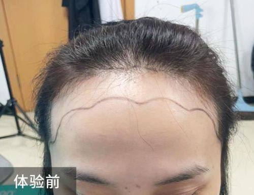 佛山市第五人民医院整形美容科特色项目及技术优势