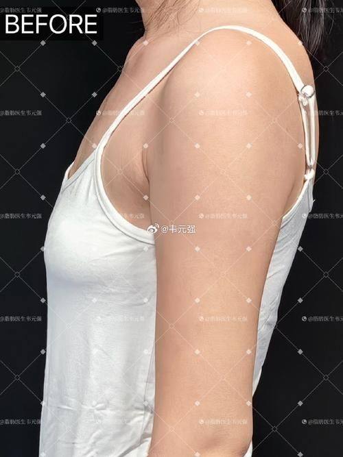 东莞西妃整形美容医院详细的预约挂号方式及流程