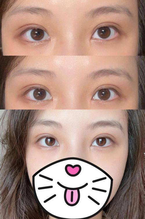 临沂东方美莱坞医疗美容是正规医院吗？