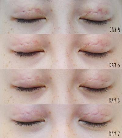 合肥红妆整形美容医院地址电话营业时间