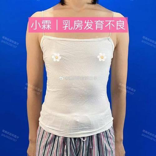 合肥红妆整形美容医院详细的预约挂号方式及流程