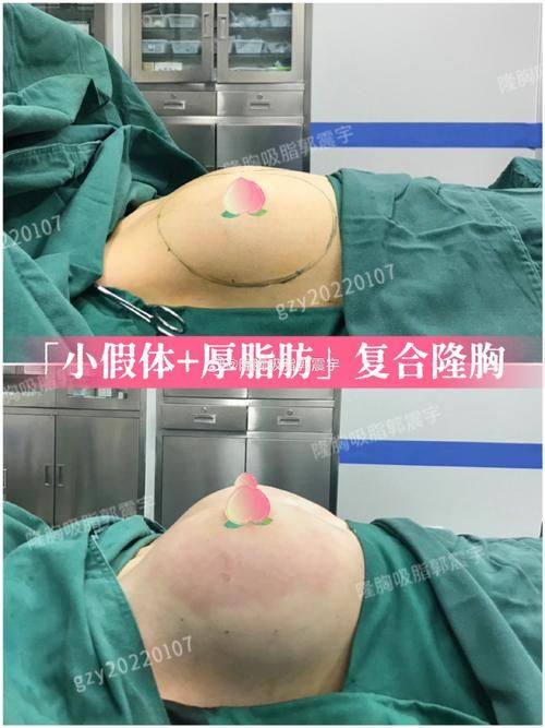 临沂东方美莱坞医疗美容真人口碑评价怎么样？