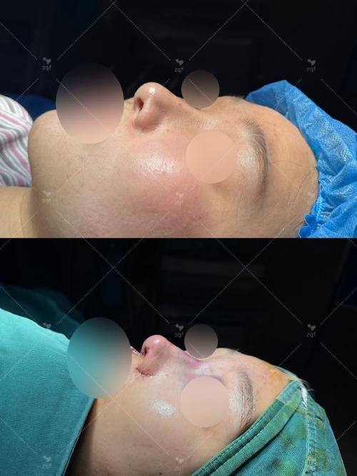 海南曙光梦妮幻整形专科门诊部真人口碑评价怎么样？